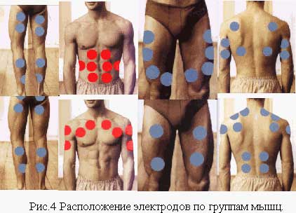 Розташування електродів по групам м'язів